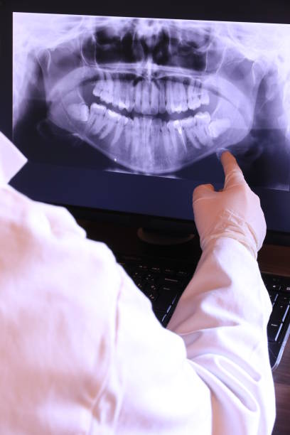 Best Broken or Cracked Tooth Emergency Dentist in West Palm Beach, FL
